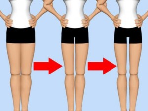 BENESSERE: “Thigh gap”, nuovo spauracchio femminile